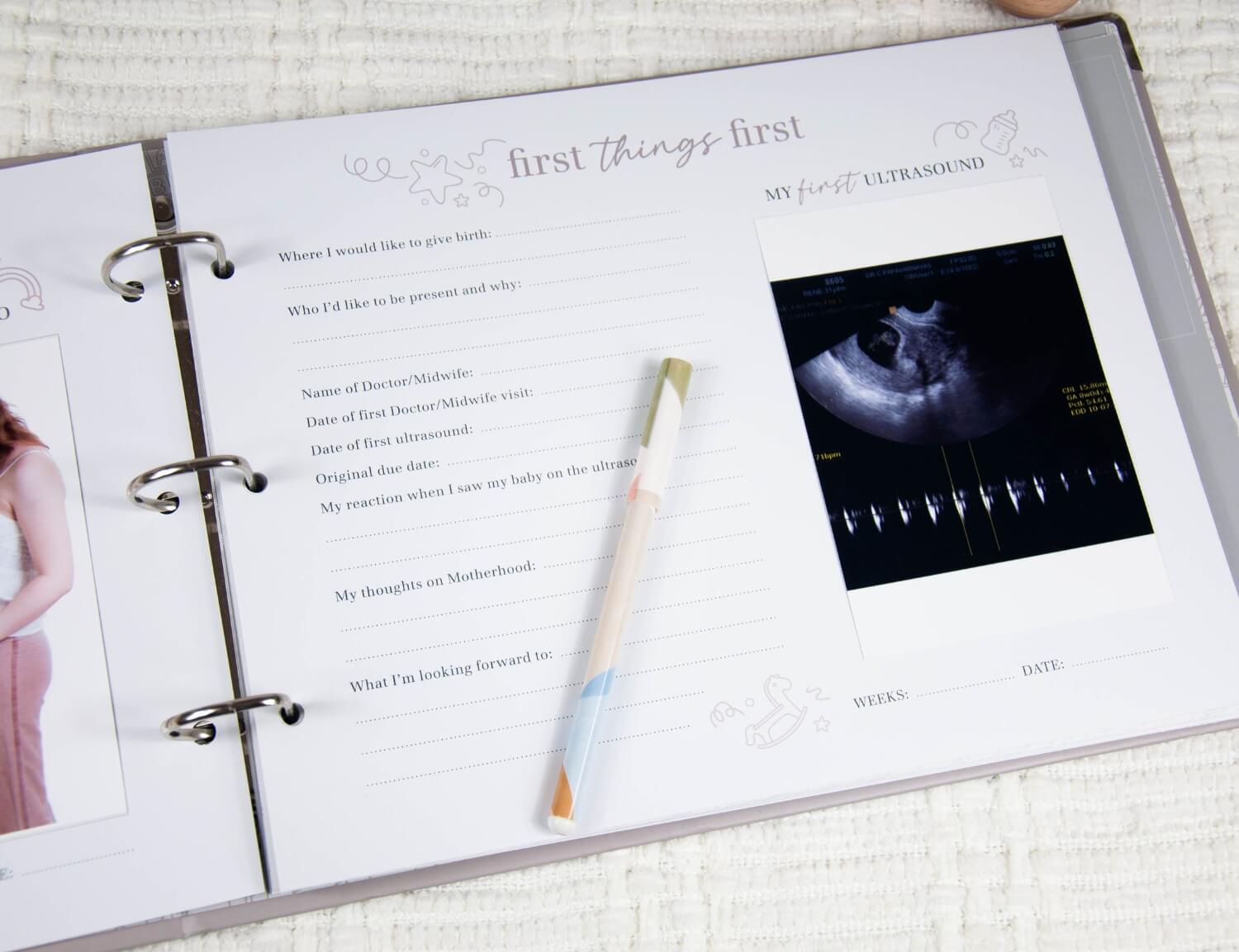 first scan in pregnancy journal